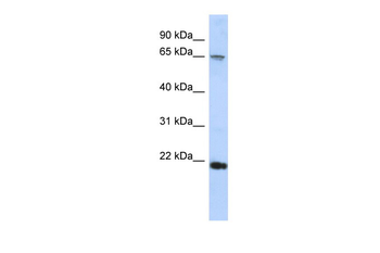 FSBP Rabbit Polyclonal Antibody