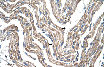 PDK4 Rabbit Polyclonal Antibody