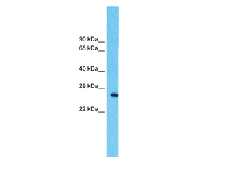PHB Rabbit Polyclonal Antibody
