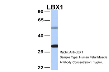 LBX1 Rabbit Polyclonal Antibody