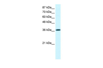 KLF1 Rabbit Polyclonal Antibody