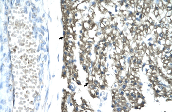 MORF4L1 Rabbit Polyclonal Antibody