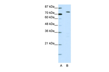 MYST2 Rabbit Polyclonal Antibody