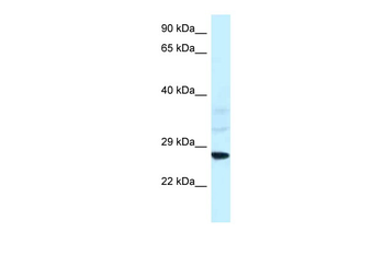 Snf8 Rabbit Polyclonal Antibody