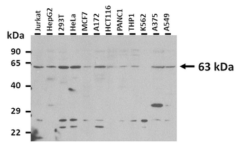 ARID3A Rabbit Polyclonal Antibody