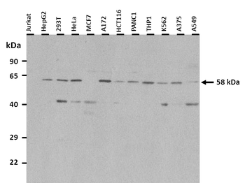 PPARG Rabbit Polyclonal Antibody