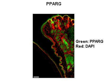 PPARG Rabbit Polyclonal Antibody
