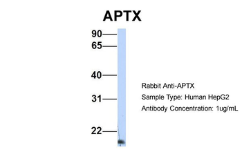 APTX Rabbit Polyclonal Antibody