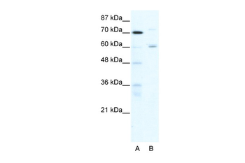 FOXJ2 Rabbit Polyclonal Antibody