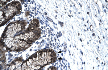 FOXJ2 Rabbit Polyclonal Antibody
