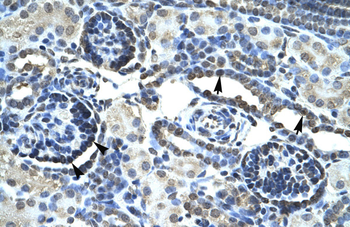JMJD1A Rabbit Polyclonal Antibody