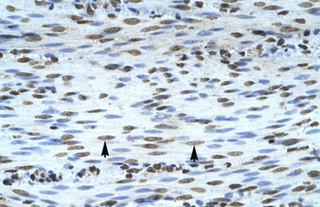 JMJD1A Rabbit Polyclonal Antibody