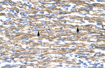 BARX1 Rabbit Polyclonal Antibody