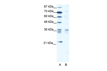 BARX1 Rabbit Polyclonal Antibody