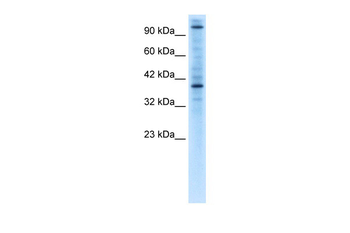 ZNF624 Rabbit Polyclonal Antibody