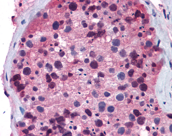 FOXO1 Rabbit Polyclonal Antibody