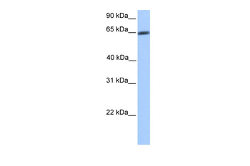 ZNF449 Rabbit Polyclonal Antibody