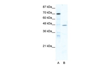 NR2F6 Rabbit Polyclonal Antibody