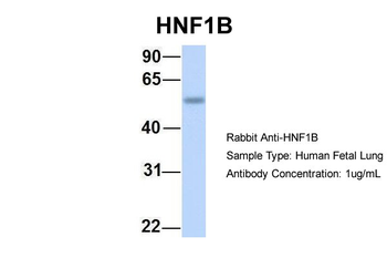 HNF1B Rabbit Polyclonal Antibody