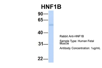 HNF1B Rabbit Polyclonal Antibody