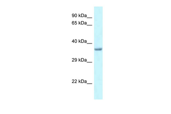 Pitx1 Rabbit Polyclonal Antibody