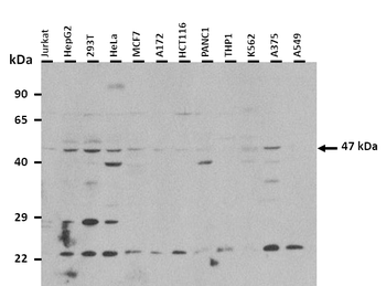 PSMD11 Rabbit Polyclonal Antibody