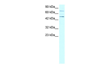 PIAS4 Rabbit Polyclonal Antibody