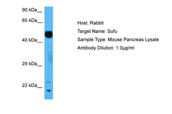 SUFU Rabbit Polyclonal Antibody