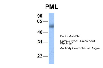 PML Rabbit Polyclonal Antibody