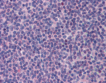 PML Rabbit Polyclonal Antibody