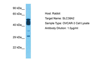 SLC38A2 Rabbit Polyclonal Antibody