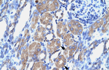 POU3F1 Rabbit Polyclonal Antibody