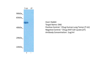 ENG Rabbit Polyclonal Antibody