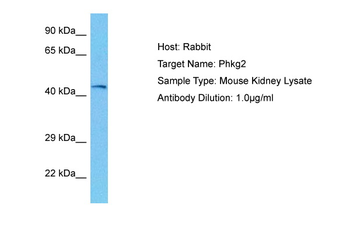 PHKG2 Rabbit Polyclonal Antibody