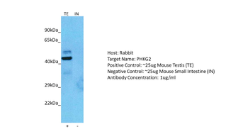 PHKG2 Rabbit Polyclonal Antibody