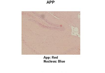 APP Rabbit Polyclonal Antibody