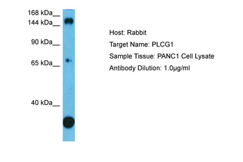 PLCG1 Rabbit Polyclonal Antibody