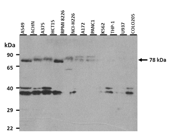 MMP9 Rabbit Polyclonal Antibody