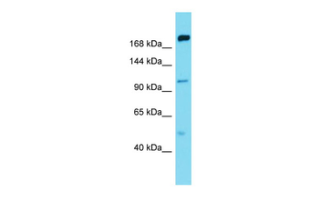 MAP4K5 Rabbit Polyclonal Antibody