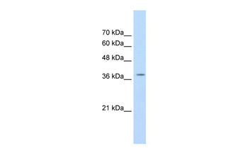RALY Rabbit Polyclonal Antibody