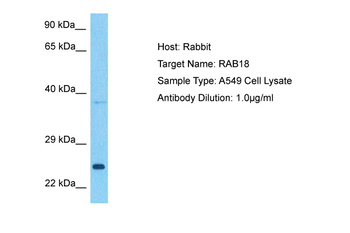 RAB18 Rabbit Polyclonal Antibody