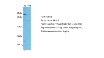 RAB18 Rabbit Polyclonal Antibody