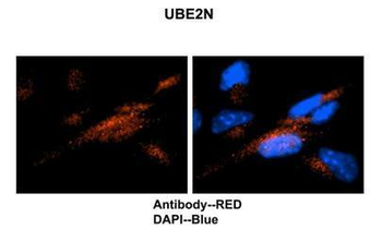 UBE2N Rabbit Polyclonal Antibody