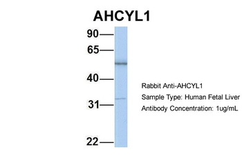 AHCYL1 Rabbit Polyclonal Antibody
