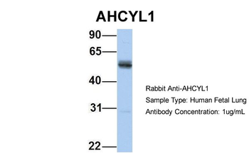 AHCYL1 Rabbit Polyclonal Antibody