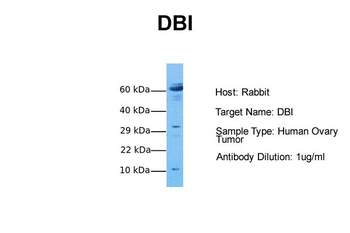 DBI Rabbit Polyclonal Antibody