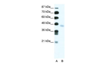 ZNF312 Rabbit Polyclonal Antibody
