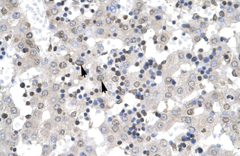 ZNF654 Rabbit Polyclonal Antibody