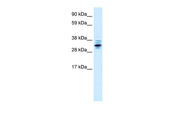 ZNF654 Rabbit Polyclonal Antibody