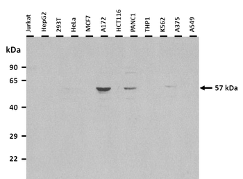 ZNF692 Rabbit Polyclonal Antibody